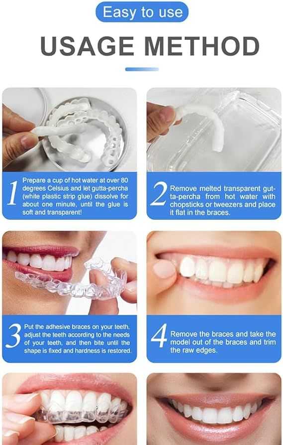 Snap-On Smile Veneers (Unisex)